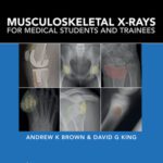 خرید و دانلود نسخه کامل کتاب Musculoskeletal X-Rays for Medical Students and Trainees