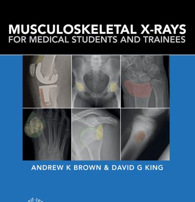 خرید و دانلود نسخه کامل کتاب Musculoskeletal X-Rays for Medical Students and Trainees