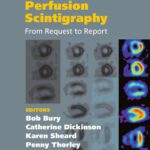 خرید و دانلود نسخه کامل کتاب Myocardial Perfusion Scintigraphy: From Request to Report