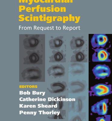 خرید و دانلود نسخه کامل کتاب Myocardial Perfusion Scintigraphy: From Request to Report