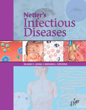 خرید و دانلود نسخه کامل کتاب Netter’s Infectious Disease