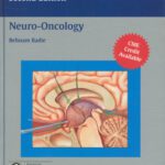 خرید و دانلود نسخه کامل کتاب Neuro-Oncology – Neurosurgical Operative Atlas 2nd Edition