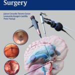 خرید و دانلود نسخه کامل کتاب Neuroendoscopic Surgery