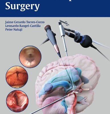 خرید و دانلود نسخه کامل کتاب Neuroendoscopic Surgery