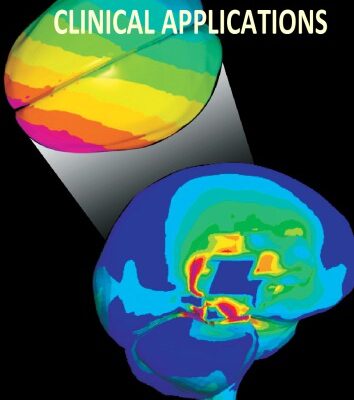خرید و دانلود نسخه کامل کتاب Neuroimaging – Clinical Applications