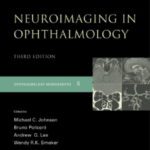 خرید و دانلود نسخه کامل کتاب Neuroimaging in Ophthalmology (Opthamology Monograph Series)