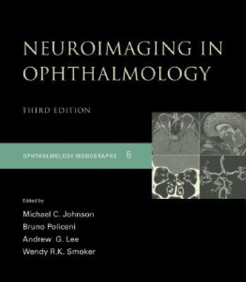 خرید و دانلود نسخه کامل کتاب Neuroimaging in Ophthalmology (Opthamology Monograph Series)