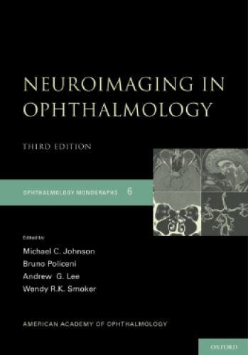 خرید و دانلود نسخه کامل کتاب Neuroimaging in Ophthalmology (Opthamology Monograph Series)_68d5ab878a214.jpeg خرید و دانلود نسخه کامل کتاب Neuroimaging in Ophthalmology (Opthamology Monograph Series)