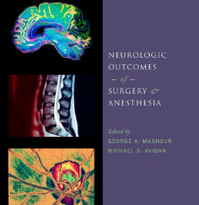 خرید و دانلود نسخه کامل کتاب Neurologic outcomes of surgery and anesthesia