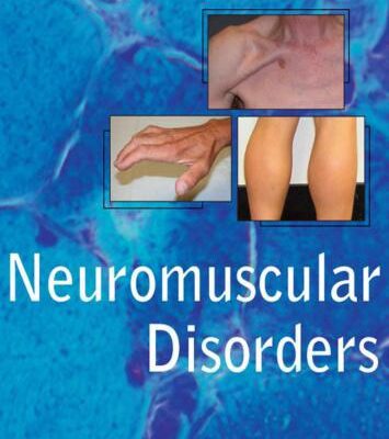 خرید و دانلود نسخه کامل کتاب Neuromuscular Disorders