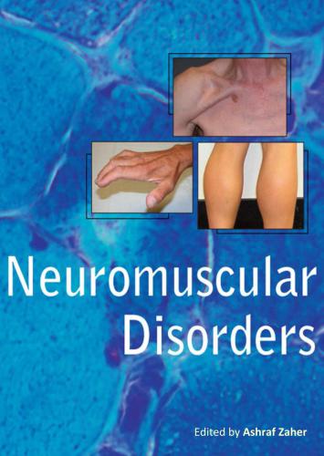 خرید و دانلود نسخه کامل کتاب Neuromuscular Disorders_68bb51ce3b8ba.jpeg خرید و دانلود نسخه کامل کتاب Neuromuscular Disorders
