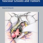 خرید و دانلود نسخه کامل کتاب Neurosurgery of Complex Vascular Lesions and Tumors
