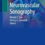 خرید و دانلود نسخه کامل کتاب Neurovascular Sonography