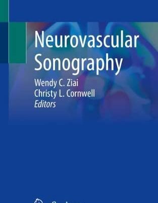 خرید و دانلود نسخه کامل کتاب Neurovascular Sonography