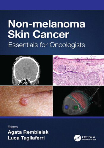خرید و دانلود نسخه کامل کتاب Non-melanoma Skin Cancer: Essentials for Oncologists_68bb11418e70f.jpeg خرید و دانلود نسخه کامل کتاب Non-melanoma Skin Cancer: Essentials for Oncologists