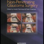 خرید و دانلود نسخه کامل کتاب Non-Penetrating Glaucoma Surgery