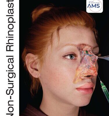خرید و دانلود نسخه کامل کتاب Non-Surgical Rhinoplasty, Riccardo Nocini, Ali Pirayesh