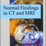 خرید و دانلود نسخه کامل کتاب Normal Findings in Ct and Mri