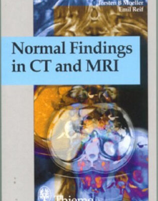 خرید و دانلود نسخه کامل کتاب Normal Findings in Ct and Mri
