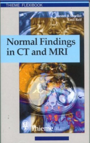 خرید و دانلود نسخه کامل کتاب Normal Findings in Ct and Mri_68baebea1715d.jpeg خرید و دانلود نسخه کامل کتاب Normal Findings in Ct and Mri