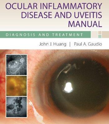 خرید و دانلود نسخه کامل کتاب Ocular Inflammatory Disease and Uveitis Manual: Diagnosis and Treatment