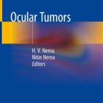 خرید و دانلود نسخه کامل کتاب Ocular Tumors
