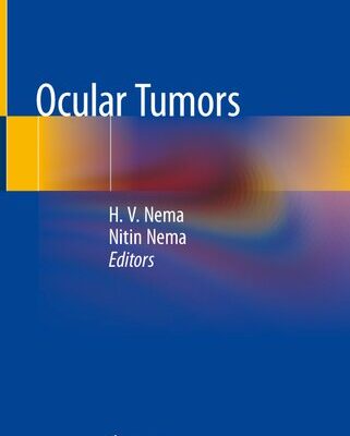 خرید و دانلود نسخه کامل کتاب Ocular Tumors