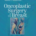 خرید و دانلود نسخه کامل کتاب Oncoplastic Surgery of the Breast