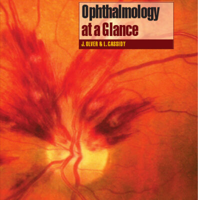 خرید و دانلود نسخه کامل کتاب Ophthalmology At a Glance