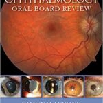 خرید و دانلود نسخه کامل کتاب Ophthalmology Oral Board Review BY Luviano –  +  Pdf