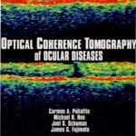 خرید و دانلود نسخه کامل کتاب Optical Coherence Tomography of Ocular Diseases