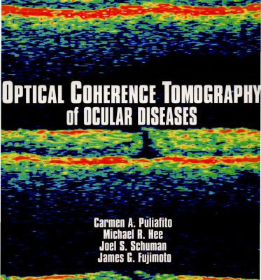 خرید و دانلود نسخه کامل کتاب Optical Coherence Tomography of Ocular Diseases