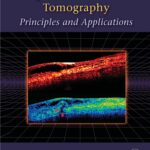 خرید و دانلود نسخه کامل کتاب Optical coherence tomography : principles and applications