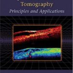 خرید و دانلود نسخه کامل کتاب Optical Coherence Tomography: Principles and Applications