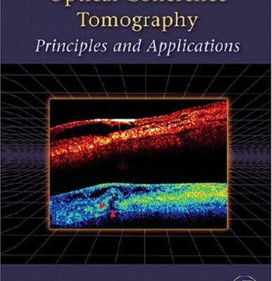 خرید و دانلود نسخه کامل کتاب Optical Coherence Tomography: Principles and Applications