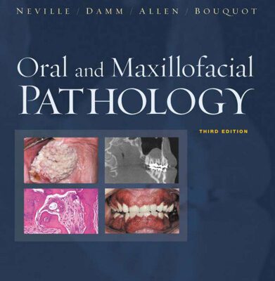 خرید و دانلود نسخه کامل کتاب Oral and Maxillofacial Pathology