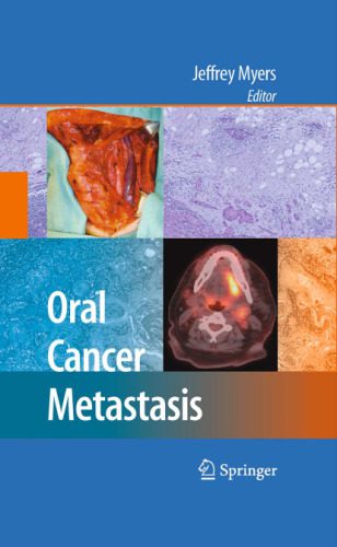 خرید و دانلود نسخه کامل کتاب Oral Cancer Metastasis_68bb473d378a3.jpeg خرید و دانلود نسخه کامل کتاب Oral Cancer Metastasis
