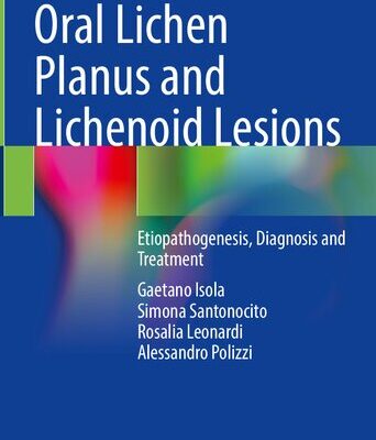 خرید و دانلود نسخه کامل کتاب Oral Lichen Planus and Lichenoid Lesions: Etiopathogenesis, Diagnosis and Treatment