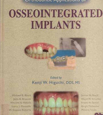 خرید و دانلود نسخه کامل کتاب Orthodontic Applications of Osseointegrated Implants