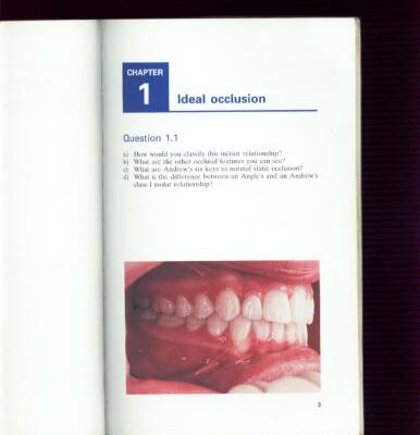 خرید و دانلود نسخه کامل کتاب Orthodontics Picture Test Atlas