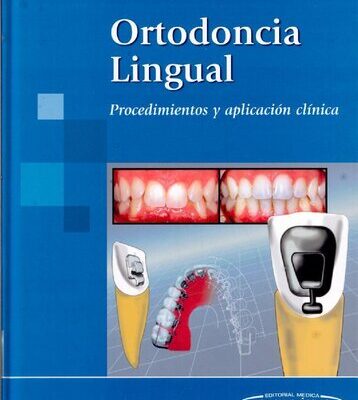 خرید و دانلود نسخه کامل کتاب Ortodoncia Lingual