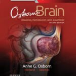 خرید و دانلود نسخه کامل کتاب Osborn’s Brain: imaging, pathology, and anatomy