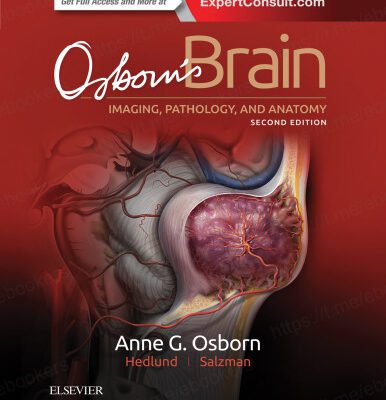 خرید و دانلود نسخه کامل کتاب Osborn’s Brain: imaging, pathology, and anatomy