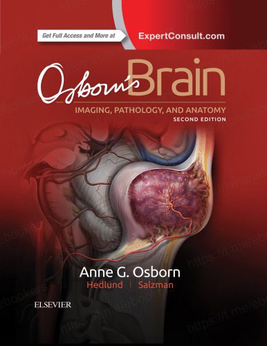 خرید و دانلود نسخه کامل کتاب Osborn’s Brain: imaging, pathology, and anatomy_68bb20bc4e547.jpeg خرید و دانلود نسخه کامل کتاب Osborn’s Brain: imaging, pathology, and anatomy
