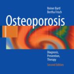 خرید و دانلود نسخه کامل کتاب Osteoporosis: Diagnosis, Prevention, Therapy, 2nd Edition