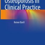 خرید و دانلود نسخه کامل کتاب Osteoporosis in Clinical Practice