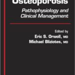 خرید و دانلود نسخه کامل کتاب Osteoporosis: Pathophysiology and Clinical Management