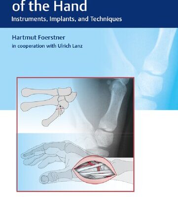 خرید و دانلود نسخه کامل کتاب Osteosynthesis of the Hand: Instruments, Implants, and Techniques