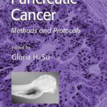 خرید و دانلود نسخه کامل کتاب Pancreatic Cancer: Methods and Protocols (Methods in Molecular Medicine)
