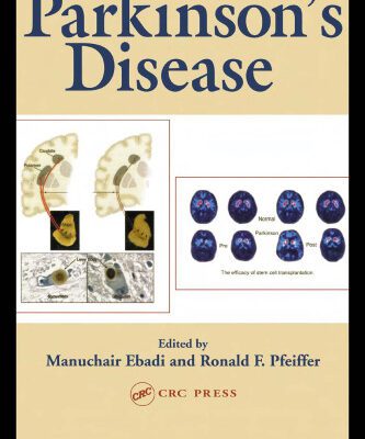 خرید و دانلود نسخه کامل کتاب Parkinson’s Disease